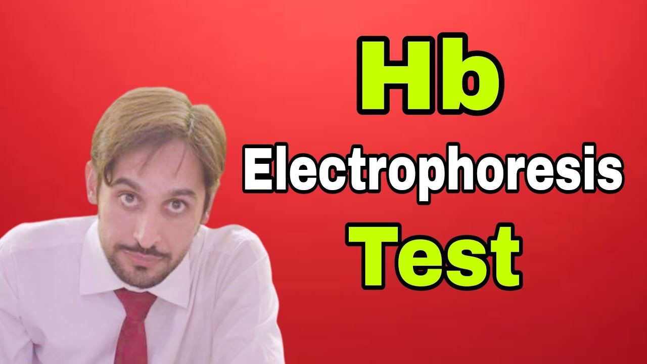 Hb Electrophoresis Test YouTube