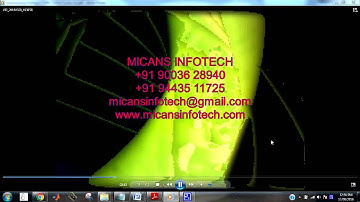 Implementing Intelligent Traffic Control System for Congestion Control