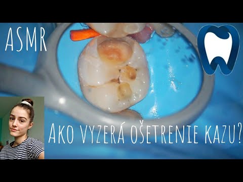 ASMR - Ako vyzerá ošetrenie kazu? | šepkanie