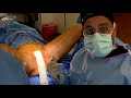 Bodytite to Inner Thighs | North Texas Plastic Surgery | Dallas, Texas