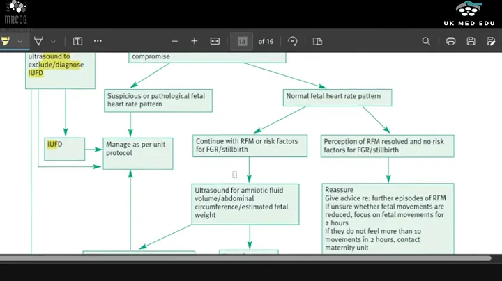Reduced fetal movements #mrcog #drripa #rcog