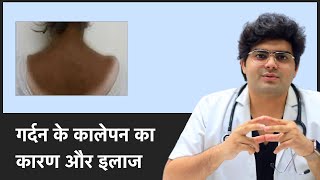 गर्दन के कालेपन का कारण और इलाज Causes And Treatment For Dark Neck | ClearSkin, Pune
