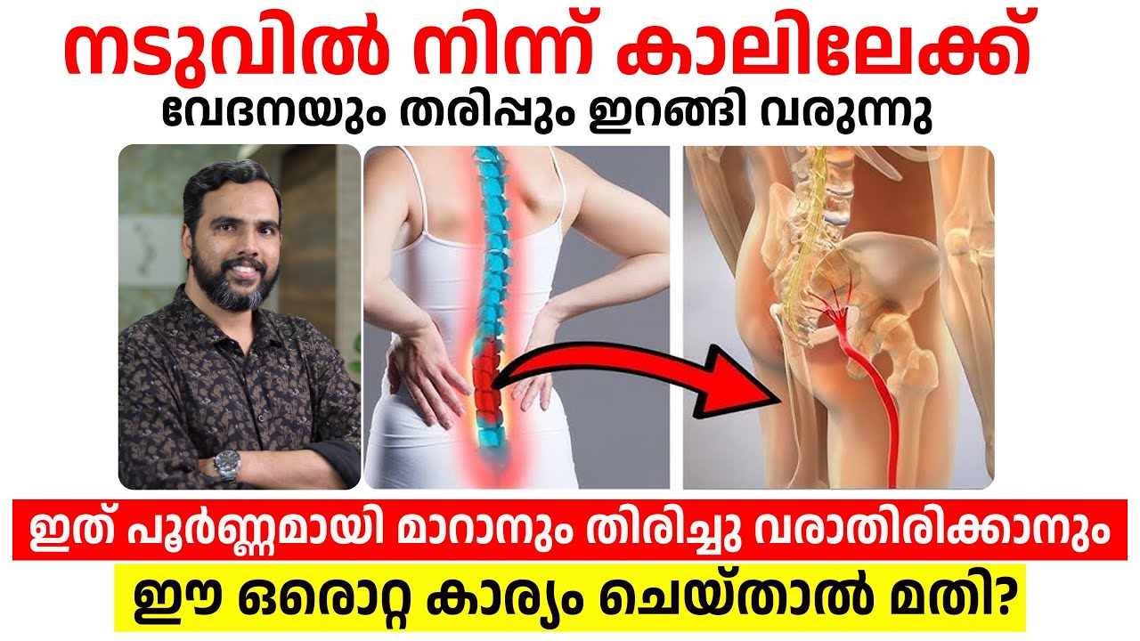 നടുവിൽ  നിന്ന് കാലിലേക്ക് വേദനയും തരിപ്പും പൂർണ്ണമായി മാറാൻ  ഈ ഒരൊറ്റ കാര്യം ചെയ്താൽ മതി Dr Nishad