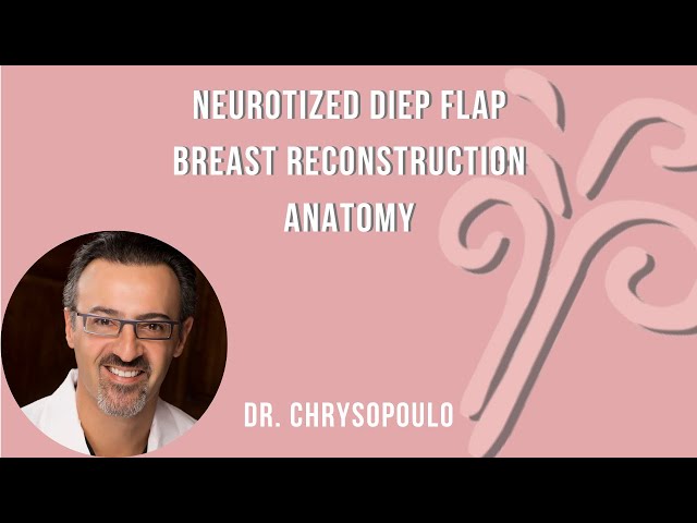 Key anatomical landmarks for DieP flap breast neurotization with