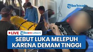 🔴LIVE: Pengakuan Ibu Tiri yang Siksa Anak di Sukabumi hingga Tewas, Sebut Luka Melepuh karena Demam
