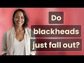 Do blackheads just fall out?