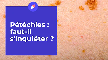 Comment reconnaître des pétéchies ?