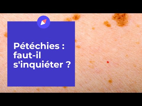 Vidéo: Causes de pétéchies chez le chien