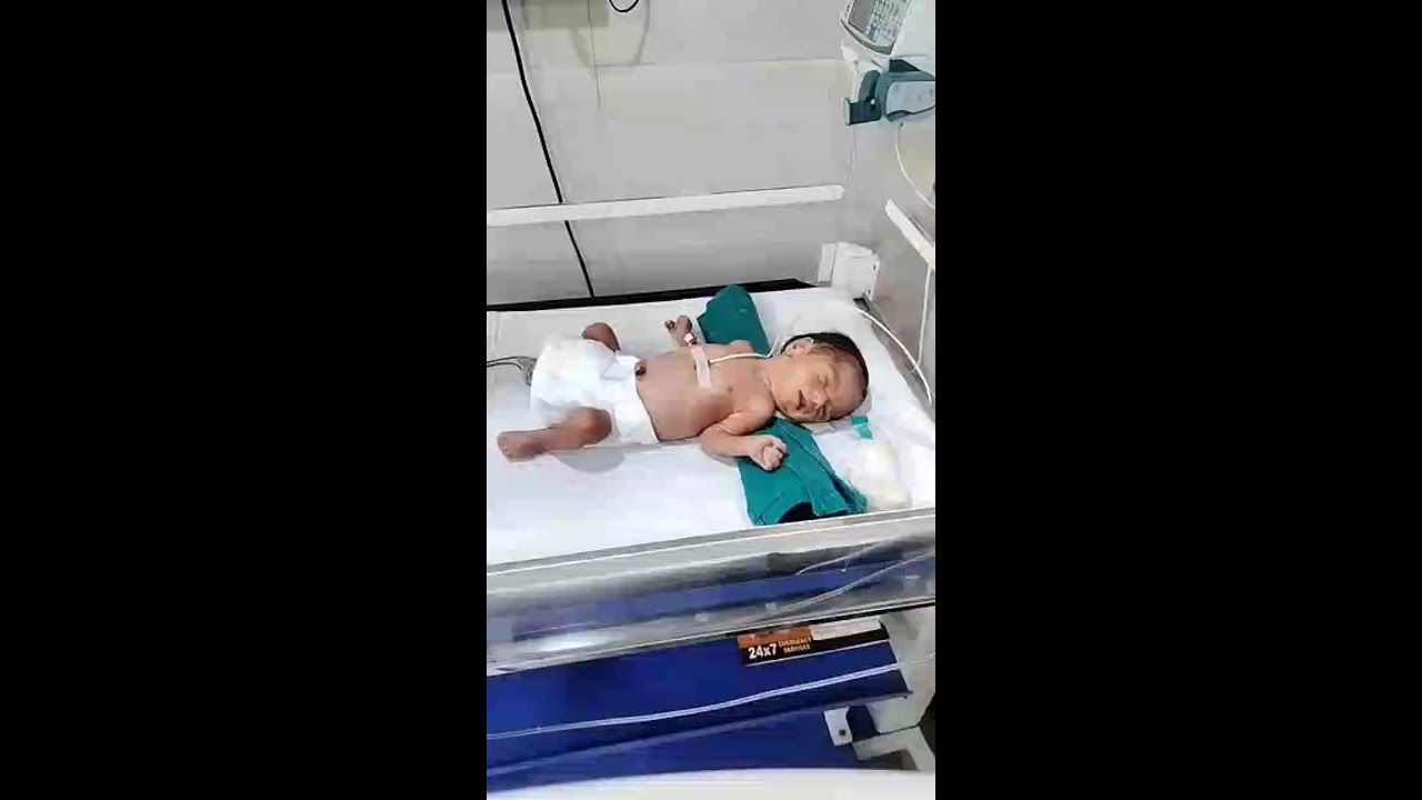 Icu and. Nicu care and treatment in NICU picu NICU