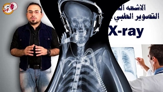 شرح الاشعه السينيه الطبية بطريقة مبسطة للجميع X-ray made simple