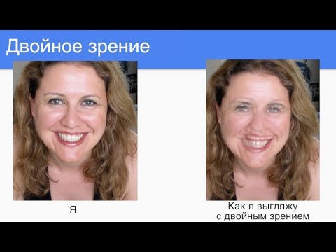 Проблемы с бинокулярным зрением