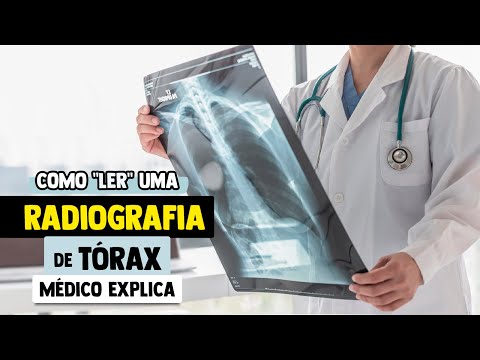 Vídeo: Como ler uma radiografia de tórax (com fotos)