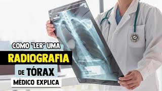 Como INTERPRETAR uma RADIOGRAFIA de Tórax │ Passo a Passo Explicado (ABCDE)