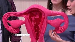 DR OZ - Menstruasi Yang Sakit Sampai Pingsan (13/5/18) Part 3 - Durasi: 10.05. 