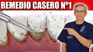 Nº1 REMEDIO CASERO para ELIMINAR la PLACA, el SARRO y PREVENIR la CARIES screenshot 2