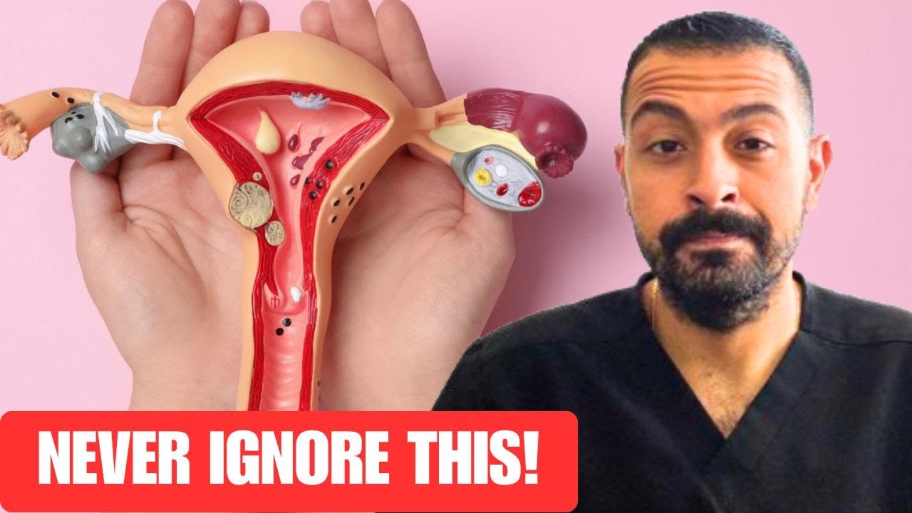 STOP Believing These Prolapse Myths!