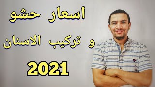 اسعار التركيبات الثابته و زراعه الاسنان و حشو العصب  2021