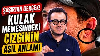 Şaşırtan Gerçek! Kulak Memesindeki Çizginin Asıl Anlamı