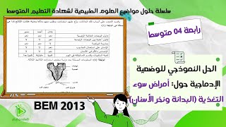 حل موضوع العلوم الطبيعية لشهادة التعليم المتوسط 2013 - حل الوضعية الإدماجية حول البدانة ونخر الأسنان