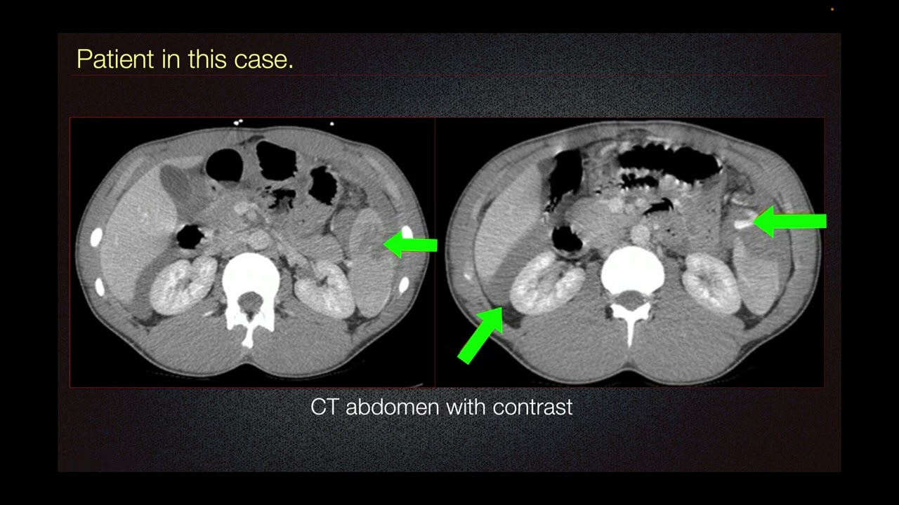 Sports Medicine Case 1 Surgical Stinger YouTube