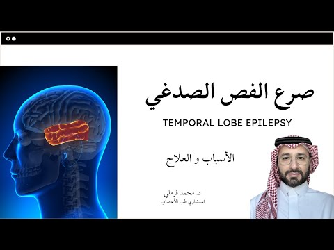 صرع الفص الصدغي الأسباب و العلاج
