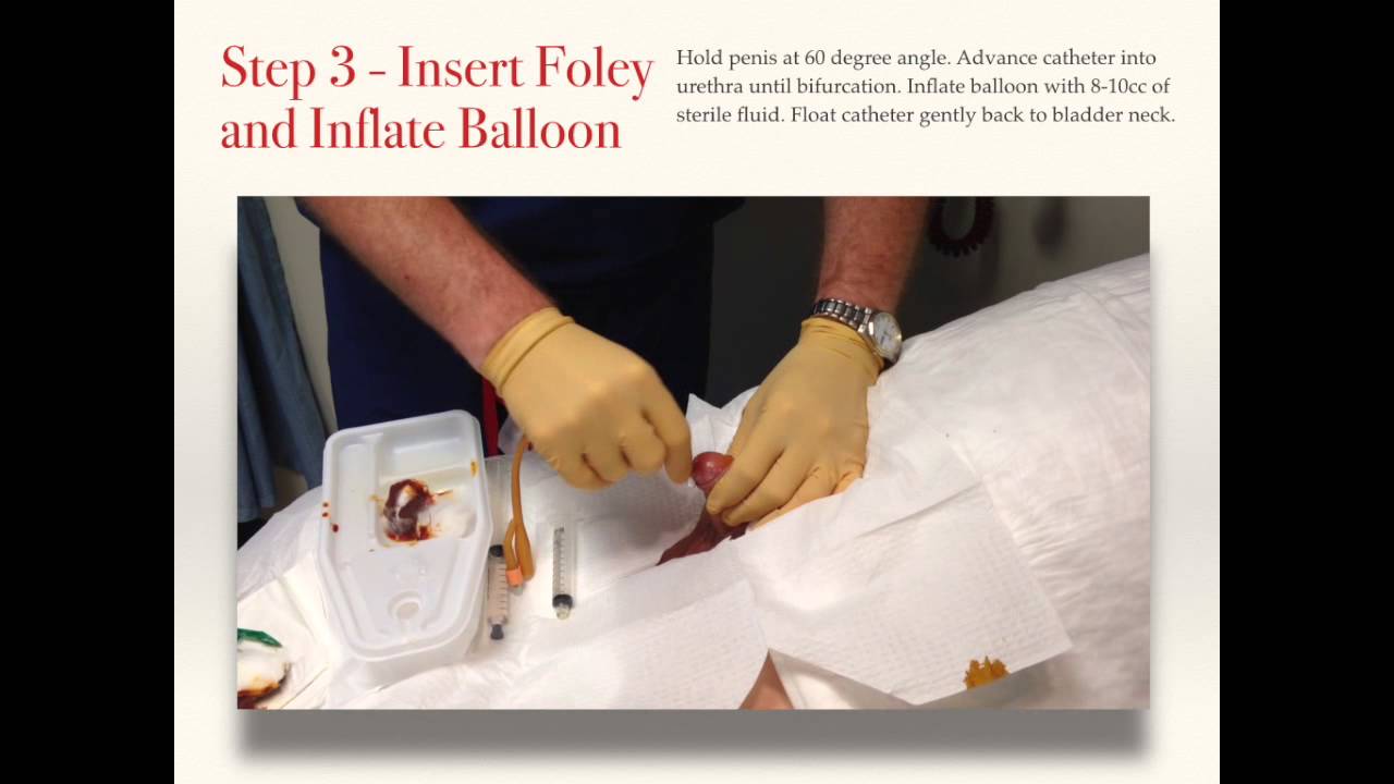 Male Foley Catheter Insertion - Placement - Best Practice ...