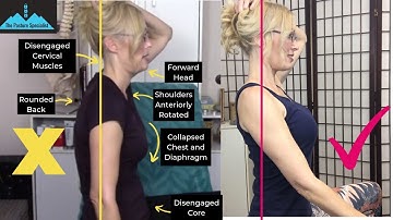 FIX FORWARD HEAD POSTURE | INSTANT CORRECTION | The Posture Specialist