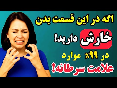این خارش ۹۹ درصد سرطان اگر خارش این نواحی را دارید و ۵۰ سال دارید فورا این ویدیو را ببینید
