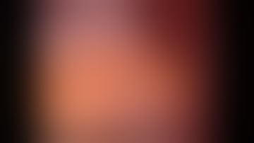 Robotic pyeloplasty on the right side   Part01