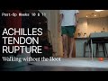 Weeks 10 & 11 - Achilles Tendon Rupture - Operative Repair Surgery - Walking without the Boot