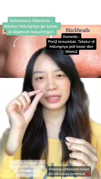 Bintik-bintik hitam di hidung, tapi BUKAN KOMEDO? 🤔