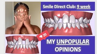 Smile Direct Club Week 9 Update | Unpopular Opinions