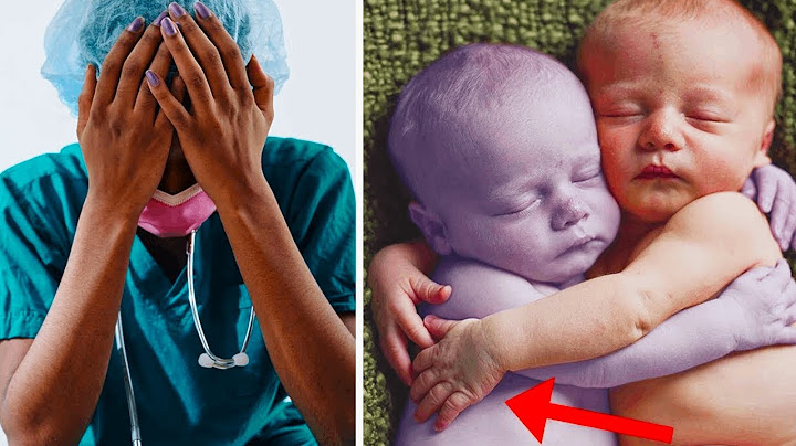 Medicinska sestra stavlja zdravu bebu pored njezine mrtvorođene sestre blizanke. Kad pogleda...