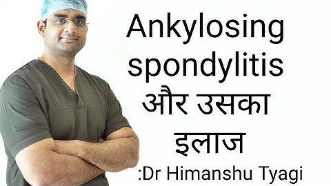 Ankylosing spondylitis और उसका इलाज/Treatment