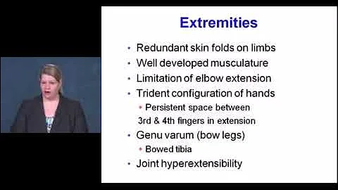 Pediatric Skeletal Dysplasia