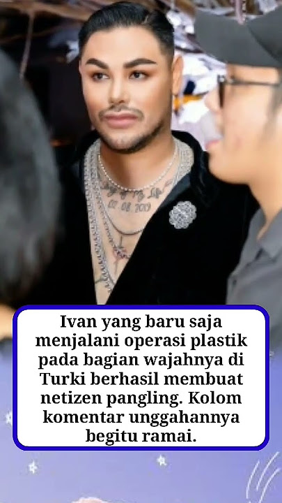 Ivan Gunawan Tampil Stunning di Acara Ultahnya, Wajah Usai Oplas Makin Ganteng