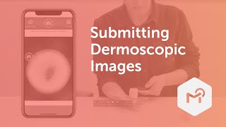 MoleScope | Submitting Dermoscopic Images screenshot 3