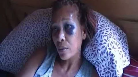 Agredida a machetazos por su ex yerno resulta la s...