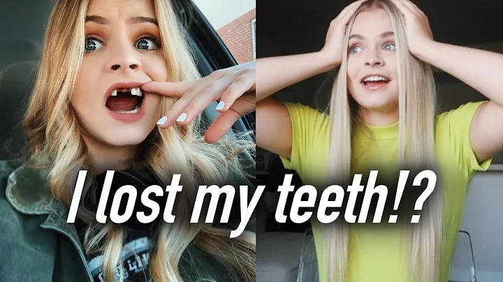 I LOST MY FRONT TWO TEETH ft. real surgery footage