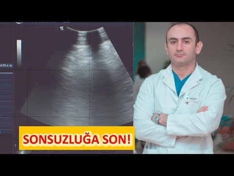 Video: Valideynlərdən Həddindən Artıq Qorunma Təhlükəsi Nə Ola Bilər