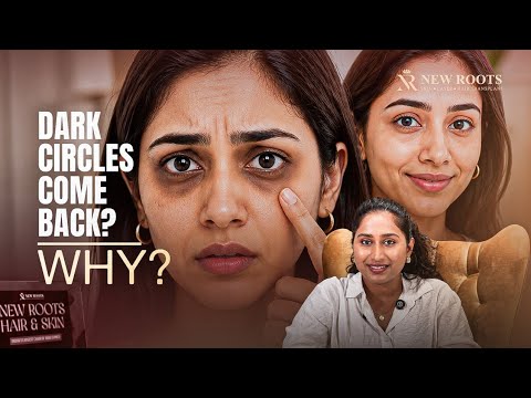 Dark Circles Explained: Why They Keep Coming Back 🤔 | New Roots
