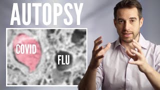 Coronavirus vs Flu vs Normal Lungs | Autopsy Comparison