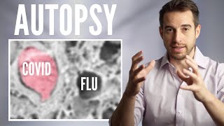 Autopsy Comparison of COVID vs. Flu vs. Normal Lungs