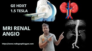 MRI Non Contrast Renal angio post processing on GE mri HDXT #MRI #RENAL ANGIO #angio