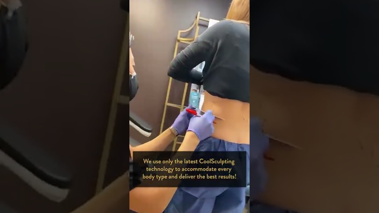 Coolsculpting assesment with Dr. Tom