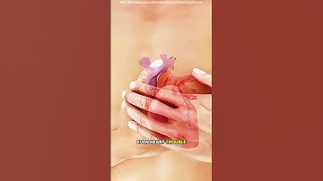 Atherectomy(3D animation) #drone #theflash #space #automobile #scifi #motivation #facts #3danimation