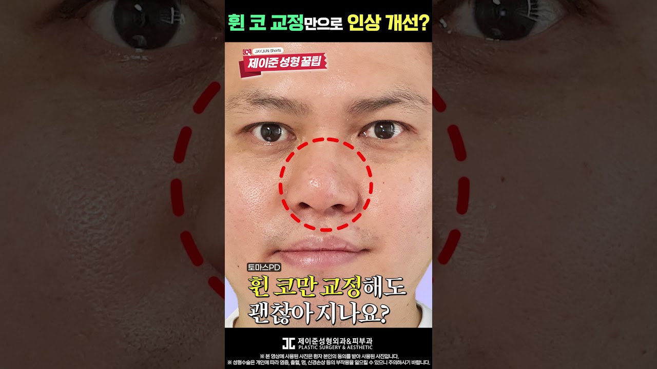 [제이준 성형외과 피부] Khắc phục mũi vẹo có thực sự thay đổi diện mạo không? #shorts