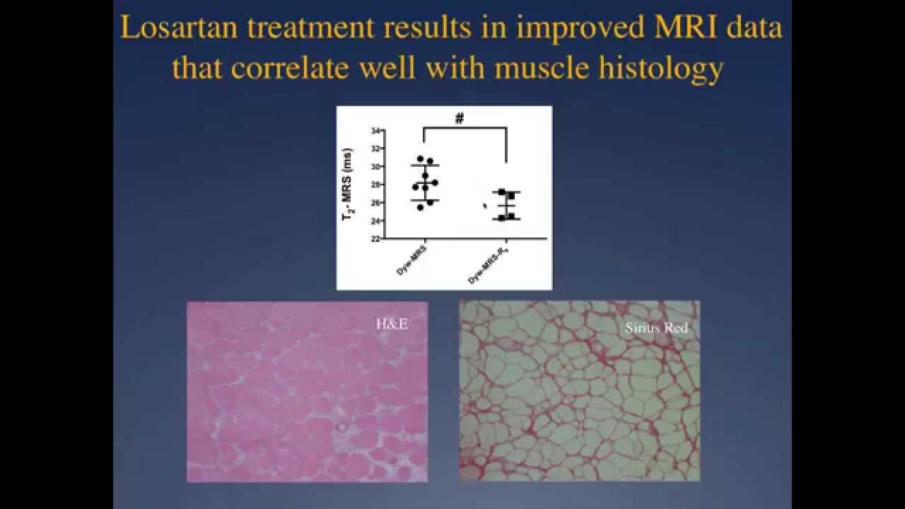 Investigating Congenital Muscular Dystrophy From Bench to Bedside)