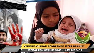 BU BAYRAM KURBANLARINIZI YEMEN'E GÖNDERMEYE NE DERSİNİZ?