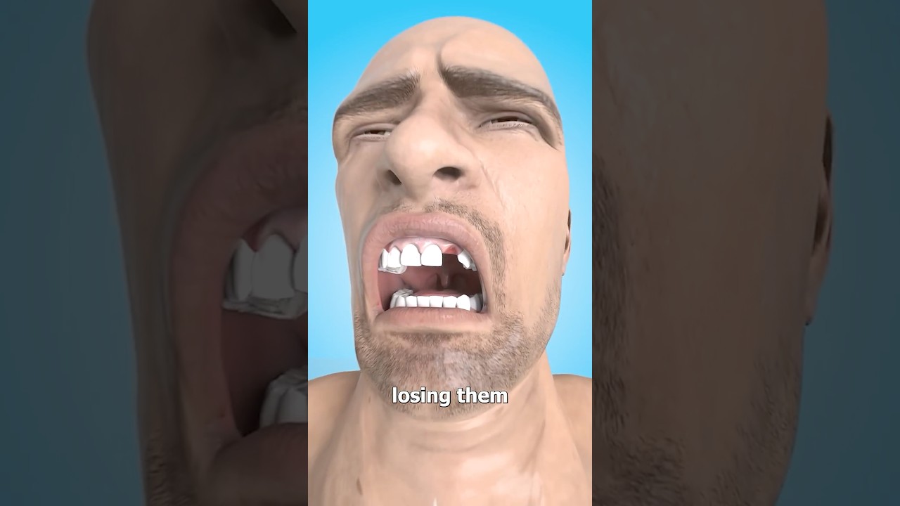 Why You Dream About Losing Teeth 🤔 Surgeon Reacts